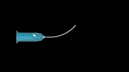 Cortex Removal Cannulas 23 Gauge